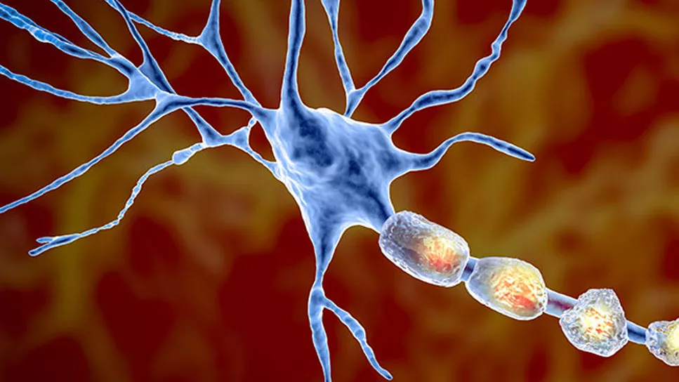 Multiple Sclerosis treatment in India for African patients