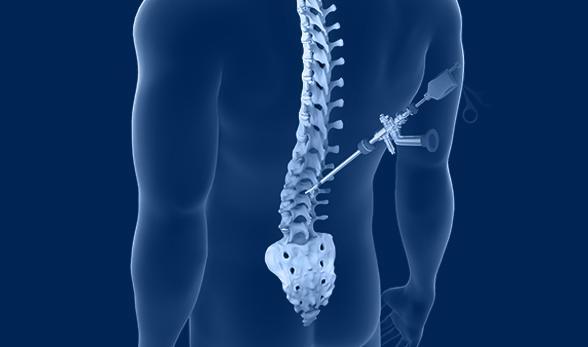 Spine Surgery treatment in India for African patients